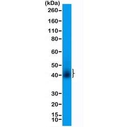 Invitrogen CD28 Recombinant Rabbit Monoclonal Antibody (RM404) 100 &mu;L;