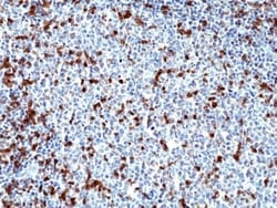 Invitrogen Zap-70 Recombinant Rabbit Monoclonal Antibody (RM408) 100 &mu;L;
