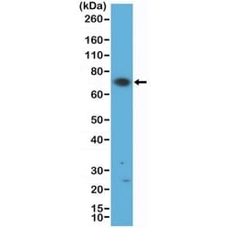 Invitrogen Zap-70 Recombinant Rabbit Monoclonal Antibody (RM408) 100 &mu;L;