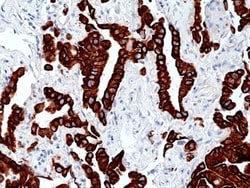 Invitrogen Cytokeratin 7 Recombinant Rabbit Monoclonal Antibody (RM416)