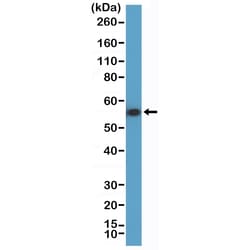 Invitrogen Cytokeratin 7 Recombinant Rabbit Monoclonal Antibody (RM416)