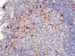 Invitrogen CD25 Recombinant Rabbit Monoclonal Antibody (RM418) 100 &mu;L;