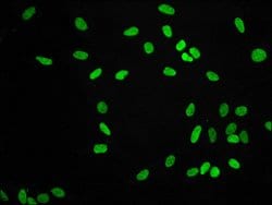 Invitrogen H3K9me2 Recombinant Rabbit Monoclonal Antibody (1A10) 100 &mu;L;