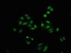 Invitrogen Phospho-PAK4/6/7 (Ser474, Ser602, Ser560) Recombinant Rabbit