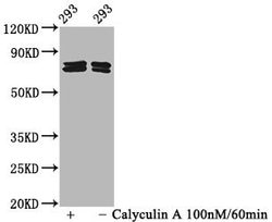 Invitrogen Phospho-PAK4/6/7 (Ser474, Ser602, Ser560) Recombinant Rabbit