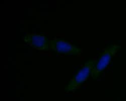 Invitrogen DFNA5 Monoclonal Antibody (A1H3) 100 &mu;L; Unconjugated:Antibodies,