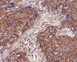 Invitrogen DFNA5 Monoclonal Antibody (A1H3) 100 &mu;L; Unconjugated:Antibodies,