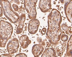 Invitrogen DFNA5 Monoclonal Antibody (A1H3) 100 &mu;L; Unconjugated:Antibodies,