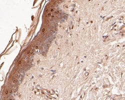 Invitrogen DFNA5 Monoclonal Antibody (A1H3) 100 &mu;L; Unconjugated:Antibodies,