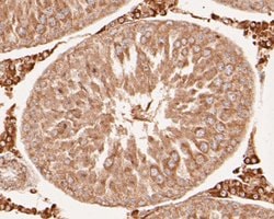 Invitrogen DFNA5 Monoclonal Antibody (A1H3) 100 &mu;L; Unconjugated:Antibodies,