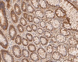 Invitrogen Aspartate Aminotransferase, Cytoplasmic Monoclonal Antibody (A2D7) 100 &mu;L | Buy Online | Invitrogen&trade; | Fisher Scientific