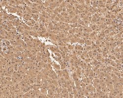 Invitrogen Aspartate Aminotransferase, Cytoplasmic Monoclonal Antibody (A2D7) 100 &mu;L | Buy Online | Invitrogen&trade; | Fisher Scientific