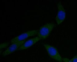 Invitrogen alpha Actinin Monoclonal Antibody (A1G2) 100 &mu;L; Unconjugated:Antibodies,