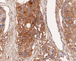Invitrogen alpha Actinin Monoclonal Antibody (A1G2) 100 &mu;L; Unconjugated:Antibodies,