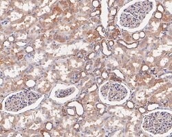Invitrogen alpha Actinin Monoclonal Antibody (A1G2) 100 &mu;L; Unconjugated:Antibodies,
