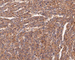 Invitrogen alpha Actinin Monoclonal Antibody (A1G2) 100 &mu;L; Unconjugated:Antibodies,