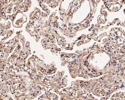 Invitrogen alpha Actinin Monoclonal Antibody (A1G2) 100 &mu;L; Unconjugated:Antibodies,