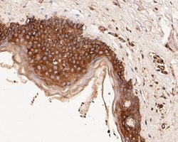 Invitrogen alpha Actinin Monoclonal Antibody (A1G2) 100 &mu;L; Unconjugated:Antibodies,