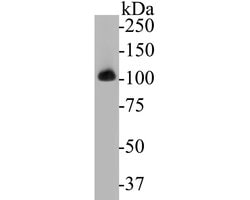 Invitrogen alpha Actinin Monoclonal Antibody (A1G2) 100 &mu;L; Unconjugated:Antibodies,