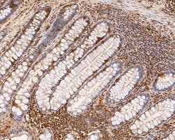 Invitrogen RUVBL2 Monoclonal Antibody (A1F1) 100 &mu;L; Unconjugated:Antibodies,