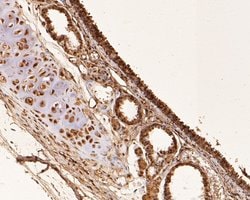 Invitrogen RUVBL2 Monoclonal Antibody (A1F1) 100 &mu;L; Unconjugated:Antibodies,