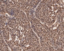 Invitrogen UBA3 Monoclonal Antibody (1C10-5-5) 100 &mu;L; Unconjugated:Antibodies,