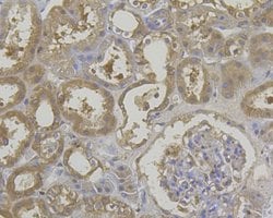 Invitrogen ROBO1 Monoclonal Antibody (10E2) 100 &mu;L; Unconjugated:Antibodies,