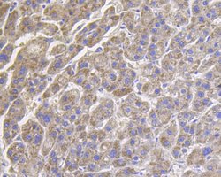 Invitrogen ROBO1 Monoclonal Antibody (10E2) 100 &mu;L; Unconjugated:Antibodies,