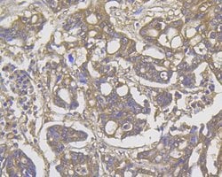 Invitrogen ROBO1 Monoclonal Antibody (10E2) 100 &mu;L; Unconjugated:Antibodies,