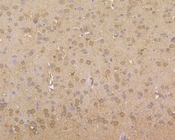 Invitrogen ROBO1 Monoclonal Antibody (10E2) 100 &mu;L; Unconjugated:Antibodies,