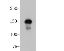 Invitrogen ROBO1 Monoclonal Antibody (10E2) 100 &mu;L; Unconjugated:Antibodies,
