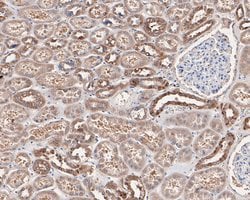 Invitrogen Annexin A3 Monoclonal Antibody (A1F7) 100 &mu;L; Unconjugated:Antibodies,