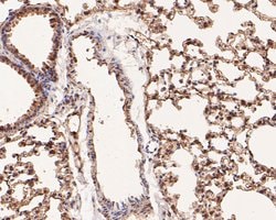Invitrogen Annexin A3 Monoclonal Antibody (A1F7) 100 &mu;L; Unconjugated:Antibodies,