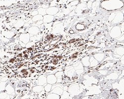 Invitrogen MTA2 Monoclonal Antibody (17A2) 100 &mu;L | Buy Online | Invitrogen&trade; | Fisher Scientific