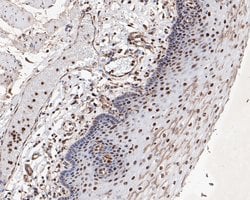 Invitrogen MTA2 Monoclonal Antibody (17A2) 100 &mu;L | Buy Online | Invitrogen&trade; | Fisher Scientific