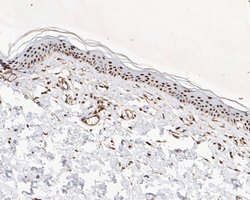 Invitrogen MTA2 Monoclonal Antibody (17A2) 100 &mu;L | Buy Online | Invitrogen&trade; | Fisher Scientific