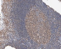 Invitrogen MTA2 Monoclonal Antibody (17A2) 100 &mu;L | Buy Online | Invitrogen&trade; | Fisher Scientific