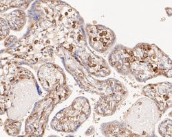 Invitrogen NFkB p100 Monoclonal Antibody (16B3) 100 &mu;L; Unconjugated:Antibodies,