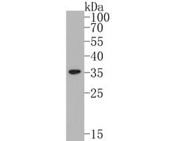 Invitrogen MCU Monoclonal Antibody (A2E11) 100 &mu;L; Unconjugated:Antibodies,