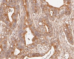 Invitrogen Cytokeratin 20 Monoclonal Antibody (A3D12) 100 &mu;L; Unconjugated:Antibodies,