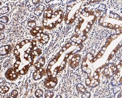 Invitrogen Cytokeratin 20 Monoclonal Antibody (A3D12) 100 &mu;L; Unconjugated:Antibodies,