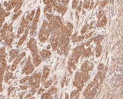 Invitrogen Cytokeratin 20 Monoclonal Antibody (A3D12) 100 &mu;L; Unconjugated:Antibodies,