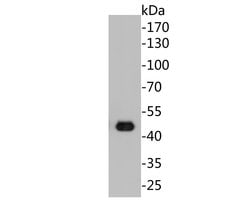 Invitrogen Cytokeratin 20 Monoclonal Antibody (A3D12) 100 &mu;L; Unconjugated:Antibodies,