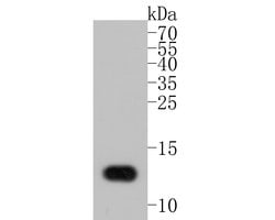 Invitrogen Lysozyme Monoclonal Antibody (A5A8) 100 &mu;L; Unconjugated:Antibodies,
