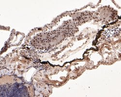 Invitrogen DDX24 Monoclonal Antibody (A3B11) 100 &mu;L; Unconjugated:Antibodies,