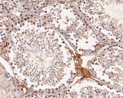 Invitrogen RAP80 Monoclonal Antibody (A1B11) 100 &mu;L; Unconjugated:Antibodies,
