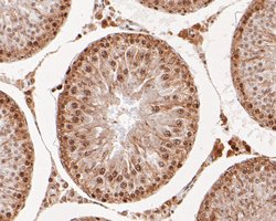 Invitrogen RAP80 Monoclonal Antibody (A1B11) 100 &mu;L; Unconjugated:Antibodies,