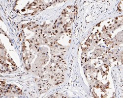 Invitrogen HMGB2 Monoclonal Antibody (10D1) 100 &mu;L; Unconjugated:Antibodies,