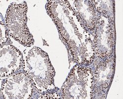 Invitrogen HMGB2 Monoclonal Antibody (10D1) 100 &mu;L; Unconjugated:Antibodies,