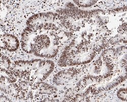 Invitrogen HMGB2 Monoclonal Antibody (10D1) 100 &mu;L; Unconjugated:Antibodies,